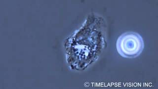 Bacterial phagocytosis by neutrophils [upl. by Culhert]