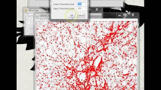 Quantifying Stained Liver Tissue Area Using ImageJ [upl. by Chansoo]