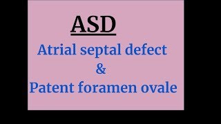 Atrial septal defect amp Patent foramen ovale [upl. by Mart]