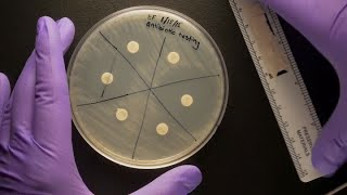 Minimal Inhibitory Concentration MIC and Minimum Bactericidal Concentration MBC  Microbiology [upl. by Anair]