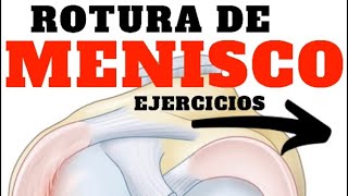 🏋🏻‍♀️ 8 Ejercicios ROTURA de MENISCO [upl. by Jollanta762]