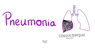 Pneumonia [upl. by Karoly]