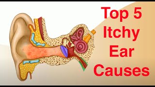 Top 5 Causes of Itchy Ears and Treatment Too [upl. by Devad]