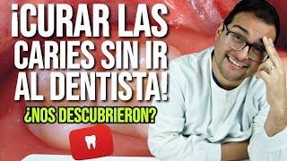 ¿QUITAR las CARIES sin ir al DENTISTA 😲 ELIMINA tus DUDAS  EXPLICACIÓN DEFINITIVA 😎 50 [upl. by Kcerred]