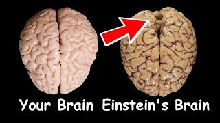 Your Brain vs Einsteins Brain [upl. by Thanos]