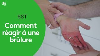 Comment réagir en cas de brûlure  Formation SST [upl. by Glynda]