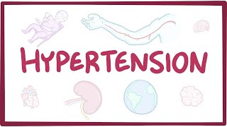 Hypertension Diagnosis and Treatment Options [upl. by Diraj480]