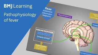 Pathophysiology of fever explained [upl. by Columbus]