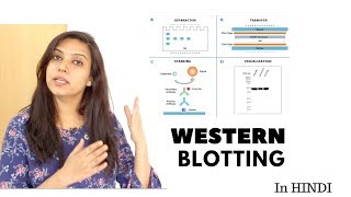 Western blotting technique  Principle  Step by Step  In Hindi [upl. by Coyle]