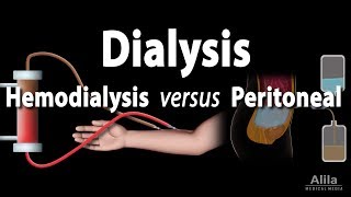 Renal Replacement Therapy Hemodialysis vs Peritoneal Dialysis Animation [upl. by Imailiv56]