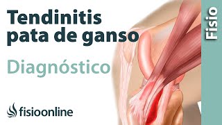 Cómo saber si tengo tendinitis de la pata de ganso [upl. by Riccio]