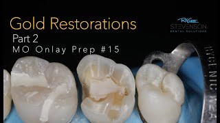 Cast Gold Restorations Part 2 MO Onlay Preparation 15 [upl. by Nolte]