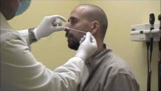 Procedure for Nasopharyngeal Swabs and Aspirates [upl. by Acimaj]