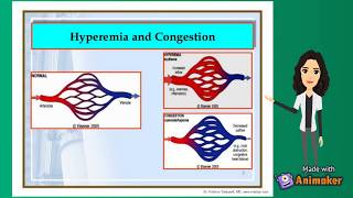 Hyperemia and Congestion  fluid and hemodynamics  pathology [upl. by Enomas]