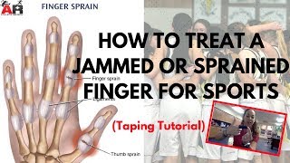 How To Treat a Jammed or Sprained Finger For Sports [upl. by Eirallam564]