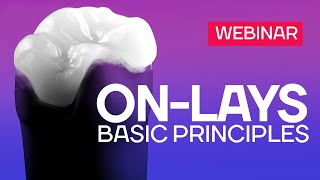 ONLays  basic principles Webinar [upl. by Dachia947]