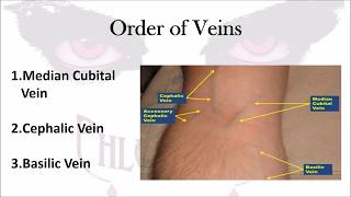 Phlebotomy The Order of Veins [upl. by Aernda]