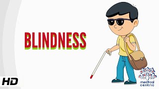 Blindness Causes Signs and Symptoms Diagnosis and Treatment [upl. by Amersham517]