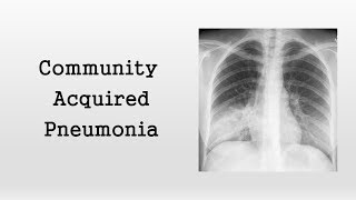 Community Acquired Pneumonia [upl. by Akit]