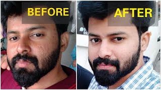 Get brighter skin Naturally in 2 Weeks  No side effects  Tamil  shadhikazeez [upl. by Ylluz247]