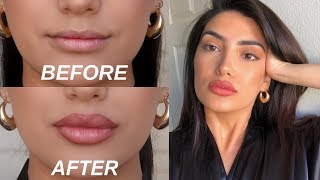 HOW TO FAKE BIG LIPS IN 3 EASY STEPS OMG [upl. by Yrtneg]