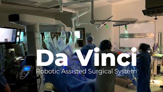 Da Vinci robotic assisted surgical system [upl. by Ledarf]