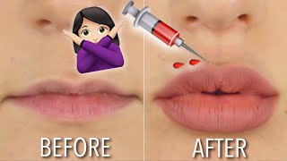 HOW TO GET FULLER LIPS AT HOME  NO FILLER  DIY  Hannah Dorman [upl. by Vickey]