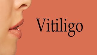 How To Say Vitiligo [upl. by Enilaf783]