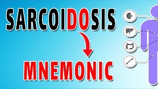 Sarcoidosis–What are my Treatment Options [upl. by Ahseki]