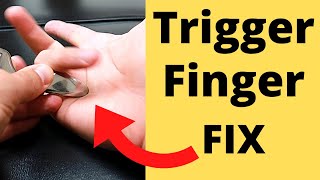 FIX Trigger Finger in 5 Minutes 3 Steps [upl. by Mraz]