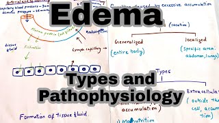 EdemaOedema  Types and its Pathophysiology [upl. by Elleimac156]