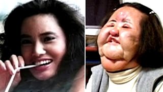 10 Worst Plastic Surgeries Disasters [upl. by Philps]