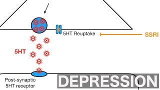 Major Depression and SSRIsSNRIs [upl. by Nadiya210]