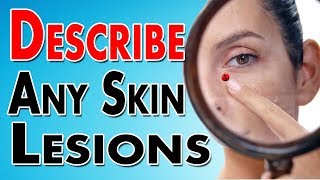 Describing Skin Lesions [upl. by Nwahsear]