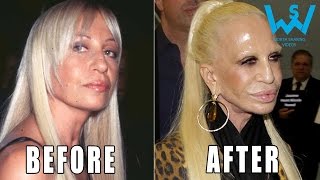 Worst celebrity plastic surgery disasters  Plastic surgery fails [upl. by Naldo74]