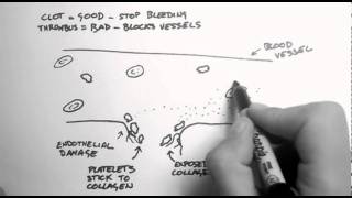 Haemostasis 1  Clots Thrombi amp Antiplatelets [upl. by Ytsirc793]