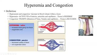 Pathology Made Easy 4 Hemodynamic Disorders [upl. by Bast374]