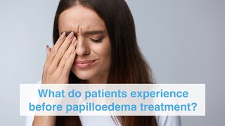 What do patients experience before papilloedema treatment [upl. by Hollyanne897]