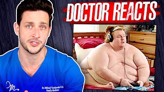 The Harsh Reality Of Being 800 Pounds  Doctor Reacts [upl. by Zonnya]