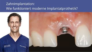 Zahnimplantation Wie funktioniert moderne Implantatprothetik [upl. by Kandace]