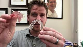 What Is The Best Orthodontic Retainer [upl. by Macri465]