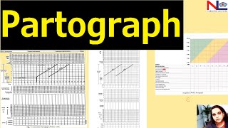 Partograph plotting  Nursing Lecture [upl. by Nirel]