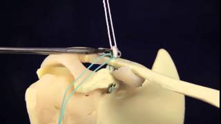 The Sternoclavicular SC Joint  Anatomy and Function [upl. by Haukom22]