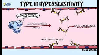 Immune ComplexMediated Hypersensitivity Type III Hypersensitivity Reaction [upl. by Day140]