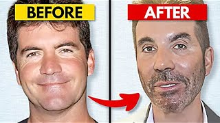 20 Celebrity Plastic Surgery Disasters [upl. by Yraeht]