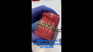 How to Cut an Orthodontic Wire at Home  David Ross Orthodontics [upl. by Nnaihs]