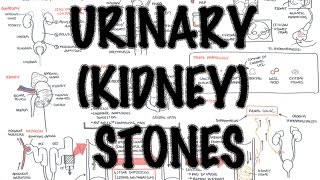 UrinaryKidney Stones  Overview signs and symptoms risk factors pathophysiology treatment [upl. by Wauters]