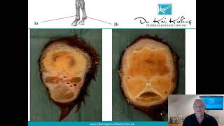 Fesselträger des Pferdes Diagnose  Therapie  Prognose [upl. by Tess]