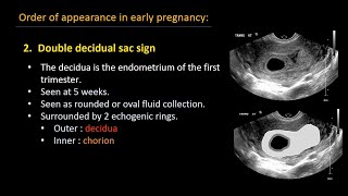 Ultrasound of normal early pregnancy [upl. by Elconin]