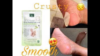 I TRIED A FOOT PEEL MASK  FOOT CARE [upl. by Bratton]